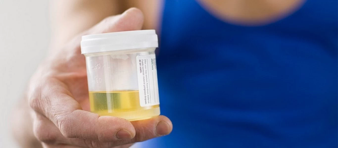 Ούρα: Ποια προβλήματα υγείας επηρεάζουν το χρώμα τους